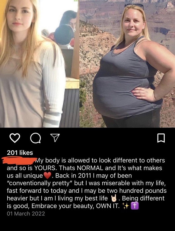 【画像あり】美人な金髪外国人女性さん、90kg太ってしまう・・・