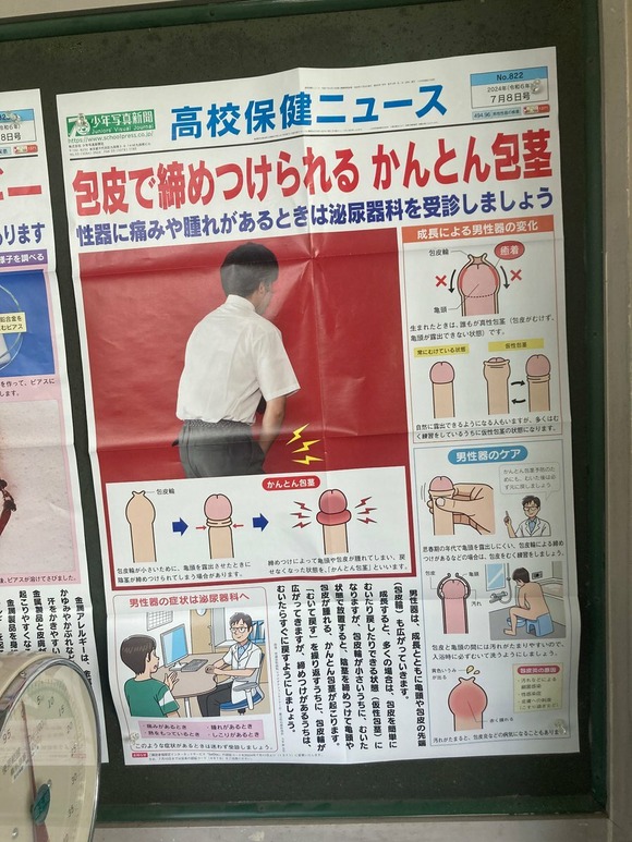 【画像】高校保健ニュース、とんでもないものを学校に掲示してしまうｗｗｗｗｗｗｗｗｗｗｗｗｗｗｗｗ