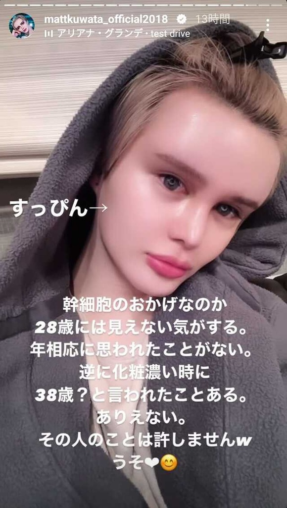 【画像】　Mattが「すっぴん」をインスタで披露して絶賛の嵐ｗｗｗｗｗｗｗｗ
