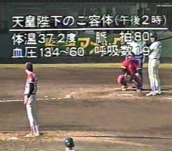 【唖然】昭和のマスコミ「陛下が崩御しそうだな...せや！」