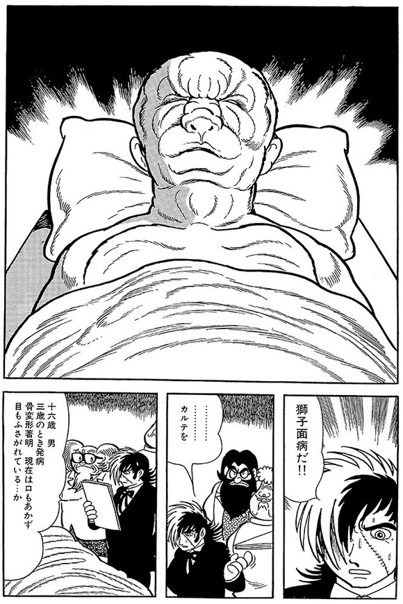 【悲報】実写ブラックジャック、なぜか「獅子面病の男」が「馬面病の女」に原作改変ｗｗｗｗｗｗｗ