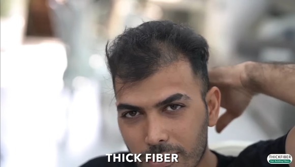 【朗報】スーパーカリスマ美容師、カットテクだけで薄毛男をフサフサにしてしまうｗｗｗｗｗｗ(画像あり)