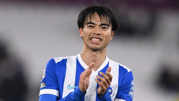 【画像】最新の三笘さん、やっぱりハゲてたｗｗｗｗｗｗ