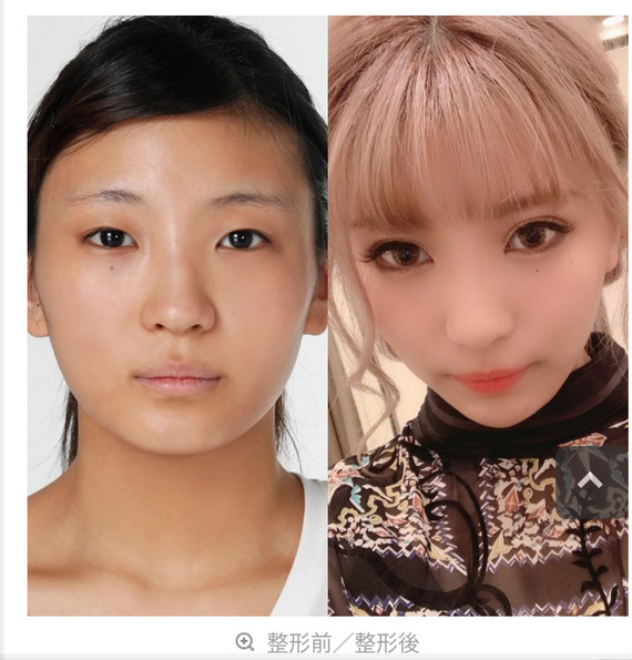 画像あり ウーパールーパーと呼ばれた うらら さん整形 なんjクエスト 画像あり ウーパールーパーと呼ばれた うらら さん整形 なんjクエスト
