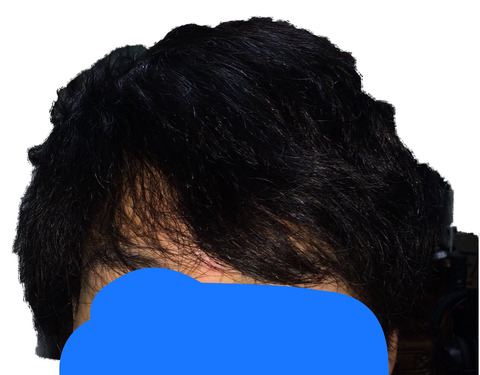 32