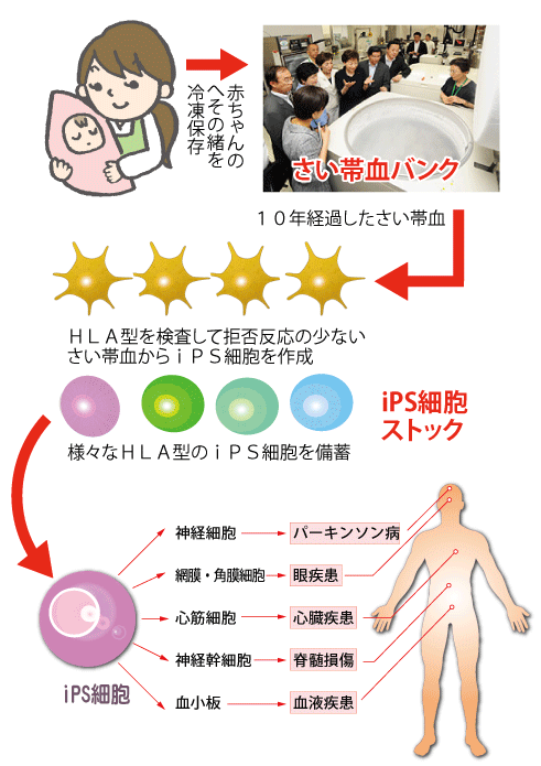 兵庫さい帯血バンク ｉｐｓ細胞ストックに協力 ほっとメール ひたち