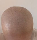 1000000841