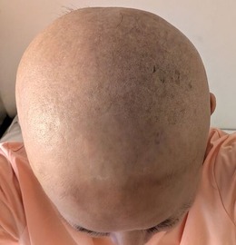 1000000775