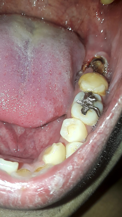 パチンコ・スロットに関連する画像