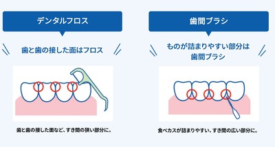 スマスロまとめ