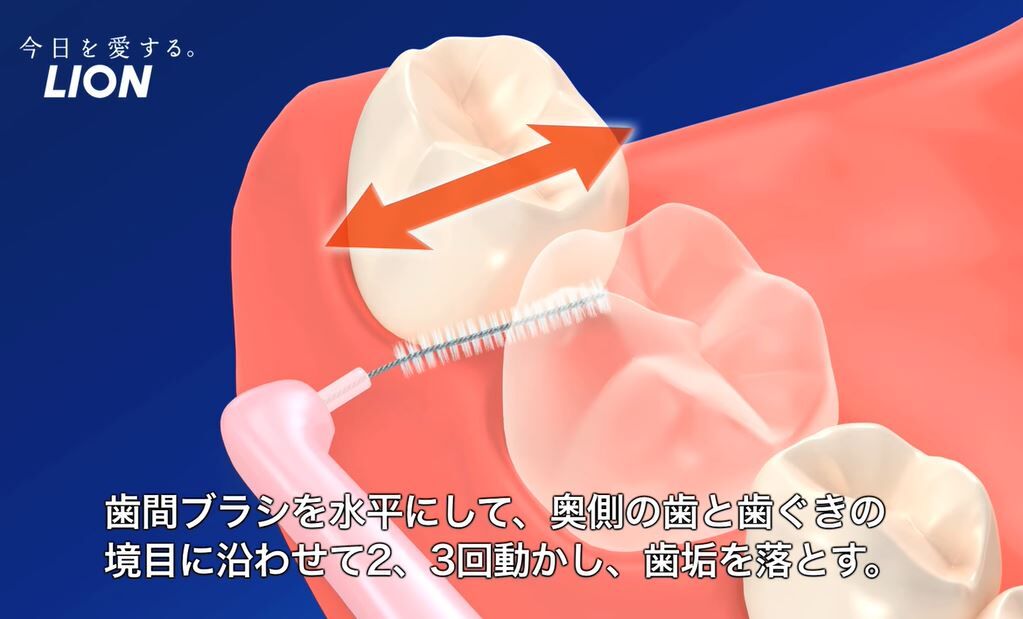 有識者 歯間ブラシは血が出るから止めとけ 鈴木さん速報 有識者 歯間ブラシは血が出るから止めとけ 鈴木さん速報