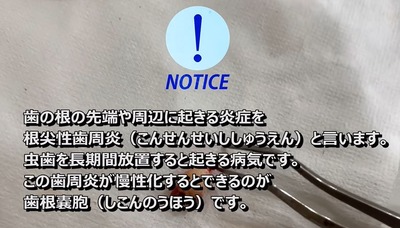 スロットまとめ