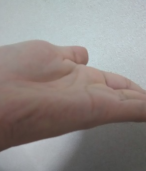 キャプチャ