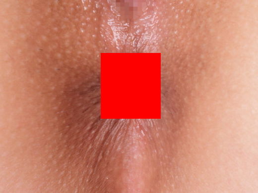 ■【肛門接写画像】アナルの形状をじっくり観察するスレ。マジで十人十色ｗｗｗｗｗｗ【24枚】