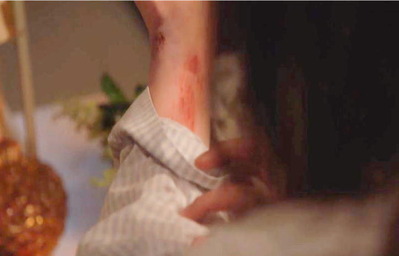 腕に血らしきものがついていた・・