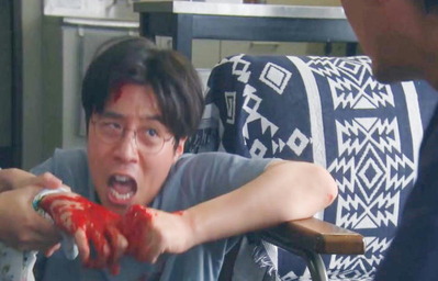 指の一本や二本・・