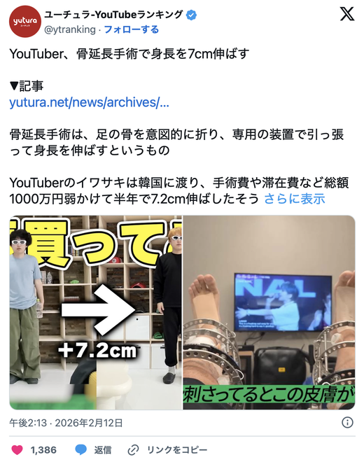 뼈 깎아서 키 7cm 샀다... 1억 태운 유튜버 실화냐? ㄷㄷ
