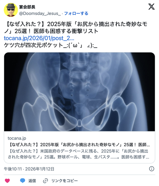 항문에서 나온 물건 랭킹… 1위 야구공, 2위 배터리식 손전등, 3위 수염 트리머