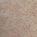 Dr.AIのお肌ブログ:2010年05月