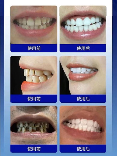 a469GGpB_700w_0