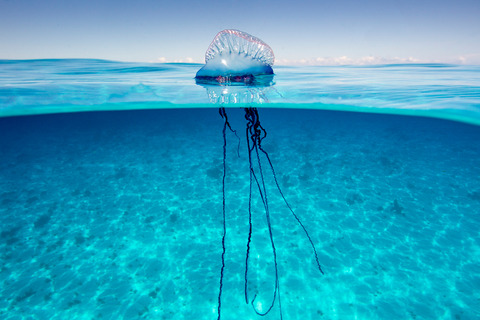 274378-1600x1066-bluebottle-stings