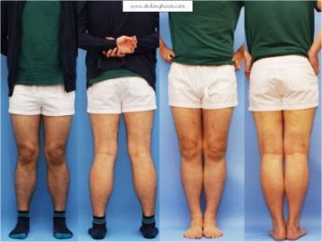 李東訓 イ ドンフン 教授の紹介 1 Dr Donghoonのブログ 李東訓 イ ドンフン 教授の紹介 1 Dr Donghoonのブログ