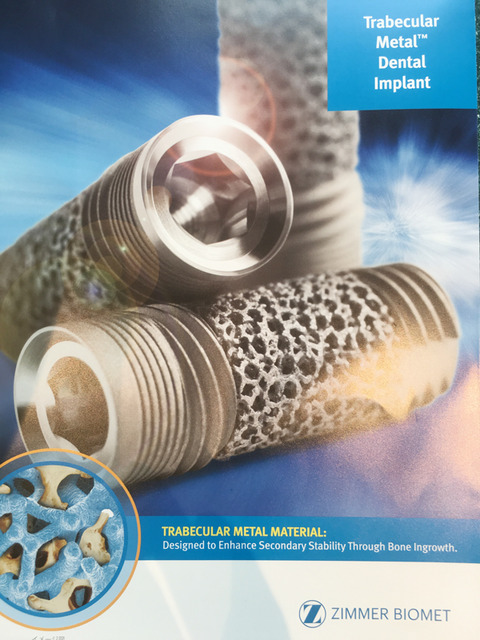 trabecular_metal_dental_implant