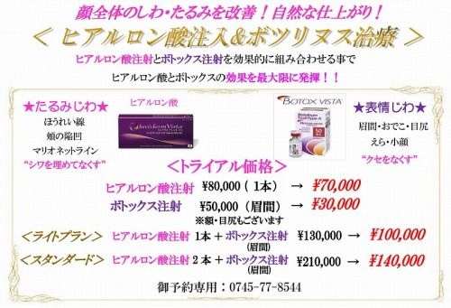 2018VISTAトライアル