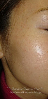 DSC02268_AL