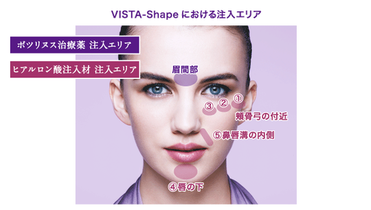 vista-shape_img_03[1]