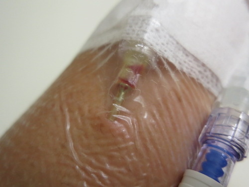 点滴 ぼーやんのお部屋