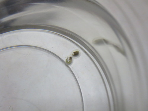 卵の中の変化 ぼーやんのお部屋