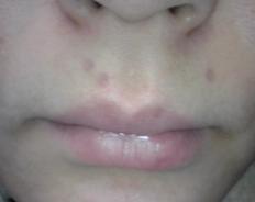 クーさまの徒然 懲りずに美容皮膚科