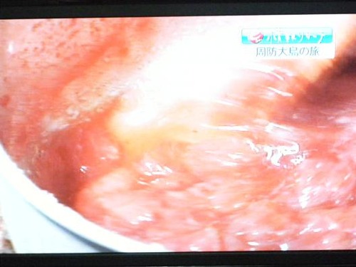 テレビ 047