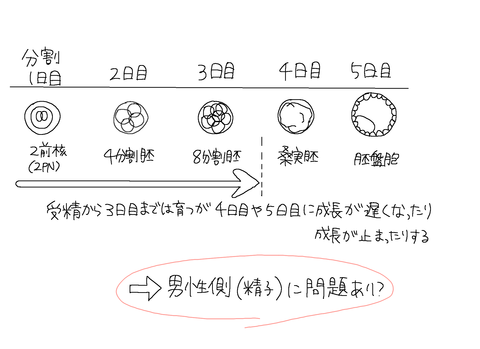 男性不妊？