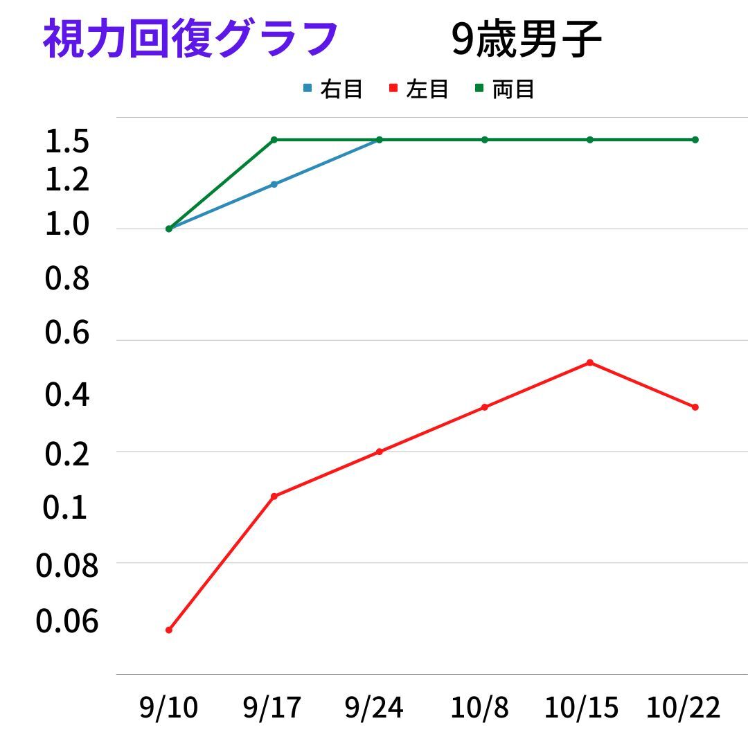 実はこわい 片目だけの視力低下 視力回復 目の疲れ アイメディカル西宮のブログ 実はこわい 片目だけの視力低下 視力回復 目の疲れ アイメディカル西宮のブログ