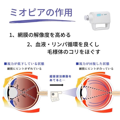 BCF7860C-5527-4B65-A79E-555B37D9AFFB