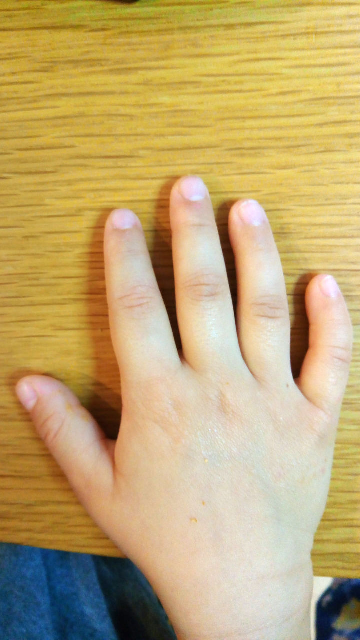 むっちりの手の小指が曲がっている件 むっちり息子とガリガリ夫
