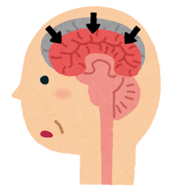 sick_ninchisyou_alzheimer