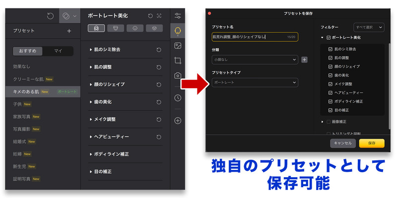 調整項目