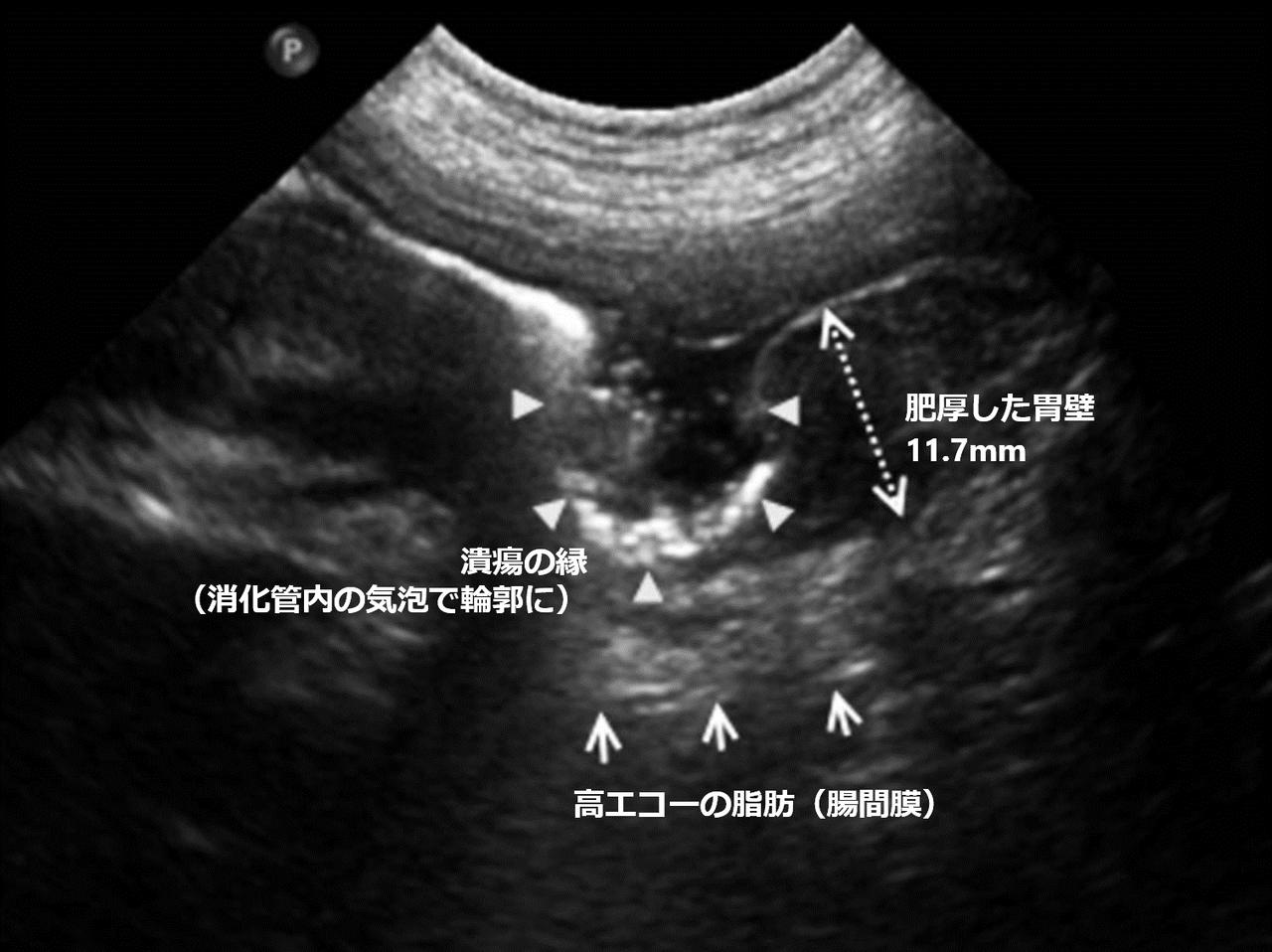 文献：犬猫] 胃十二指腸潰瘍の病態生理学と疫学（PMID: 27841680 