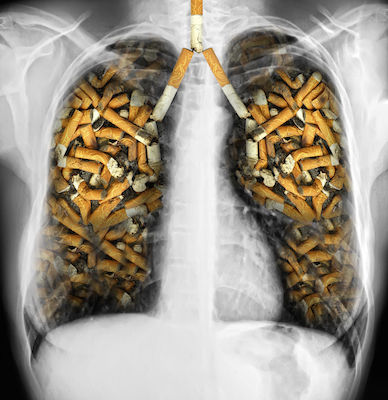 電子タバコガイド はじめに なぜ電子タバコをはじめたのか E Cig道 電子タバコガイド 情報ブログ