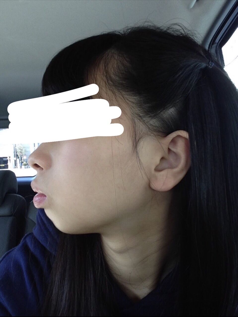 親 鼻呼吸しろ 口閉じろ 寝る時はうつ伏せで寝ろ 舌の位置は上顎 ニジ速