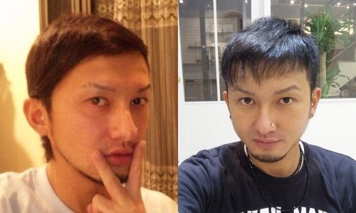 選択した画像 はげ あがる 最高の画像をダウンロード