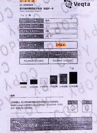 レベル4で陽性(緑内障遺伝子検査の結果)