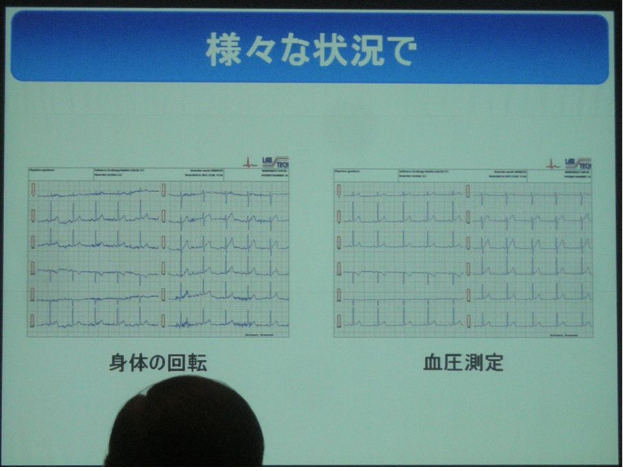 スマホを用いた１２誘導心電図伝送システム パソコン応用インターネット１２誘導解析付心電計