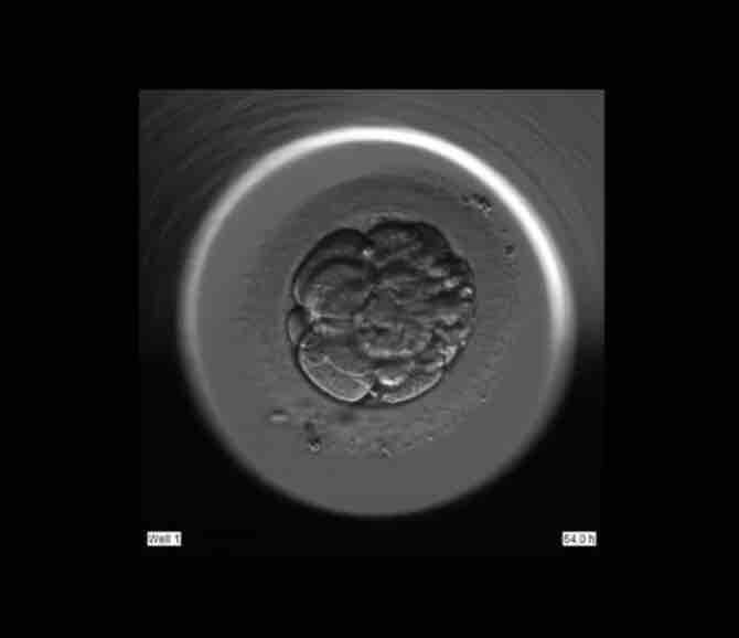 治療まとめ 移植した受精卵 えるの不妊治療ブログ 体外受精にステップアップするまでの経緯とこれから 治療まとめ 移植した受精卵 えるの不妊治療ブログ 体外受精にステップアップするまでの経緯とこれから