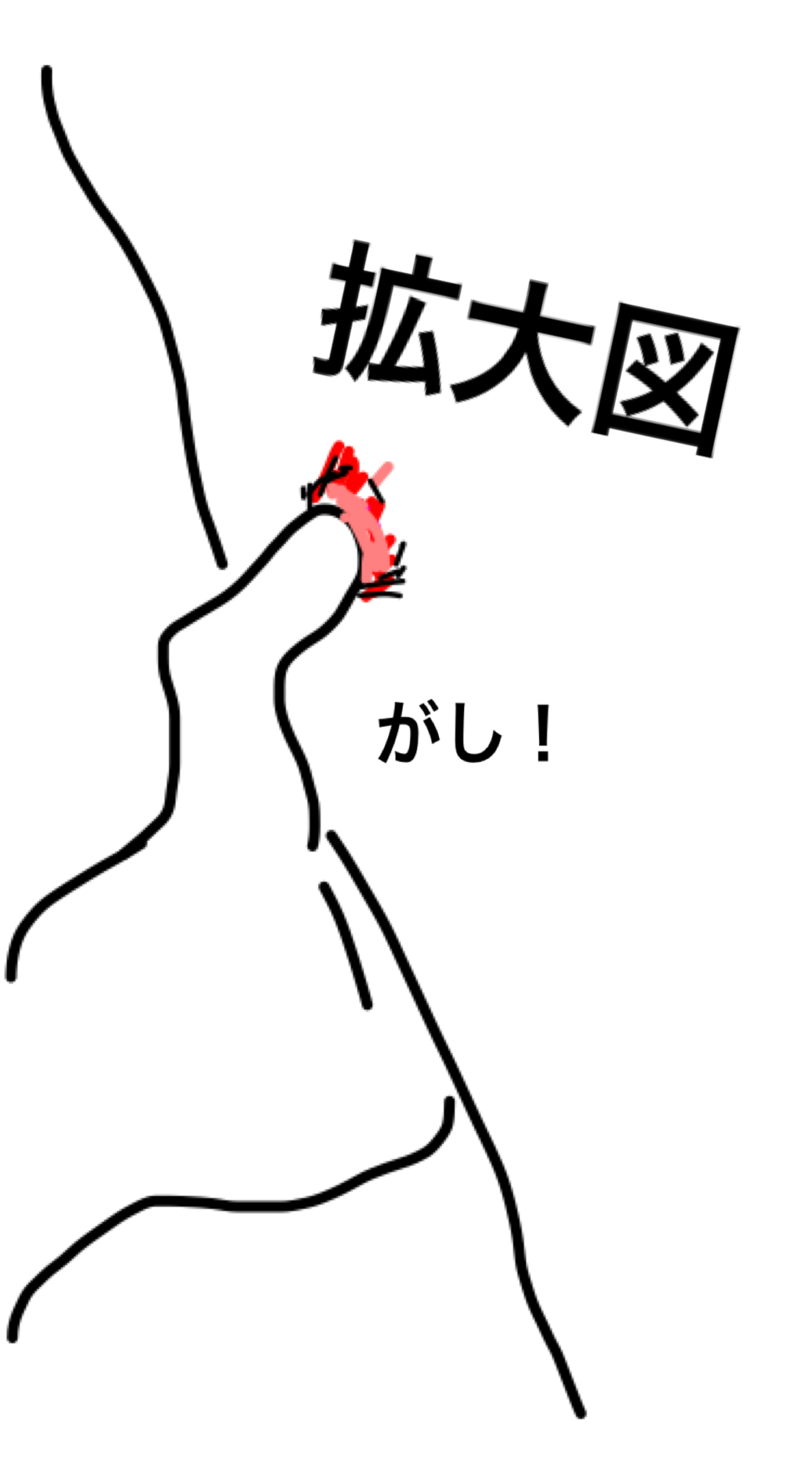 上 傷 イラスト 傷 イラスト 描き方 Blogimgjprolas 上 傷 イラスト 傷 イラスト 描き方 Blogimgjprolas