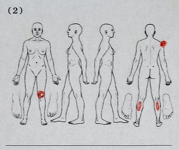 20140420 クリニック 身体チェック-2