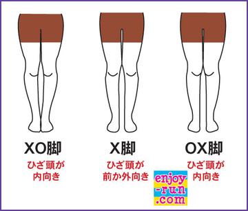 Xo脚 X脚 Ox脚の人もいます 整体師に学ぶ 中高年のランニングによる筋肉痛改善と 楽に長く走る方法 エンジョイラン Com